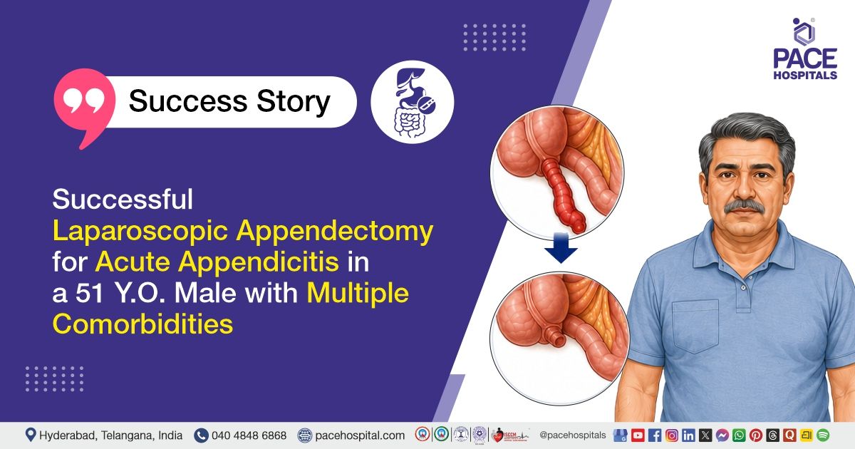Laparoscopic Appendectomy for Acute Appendicitis