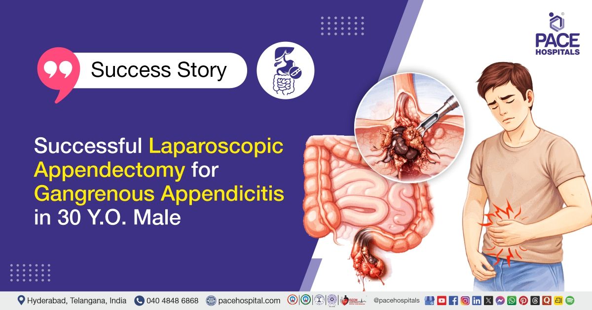 Ci Appendix Laparoscopic Appendectomy for Gangrenous Appendix