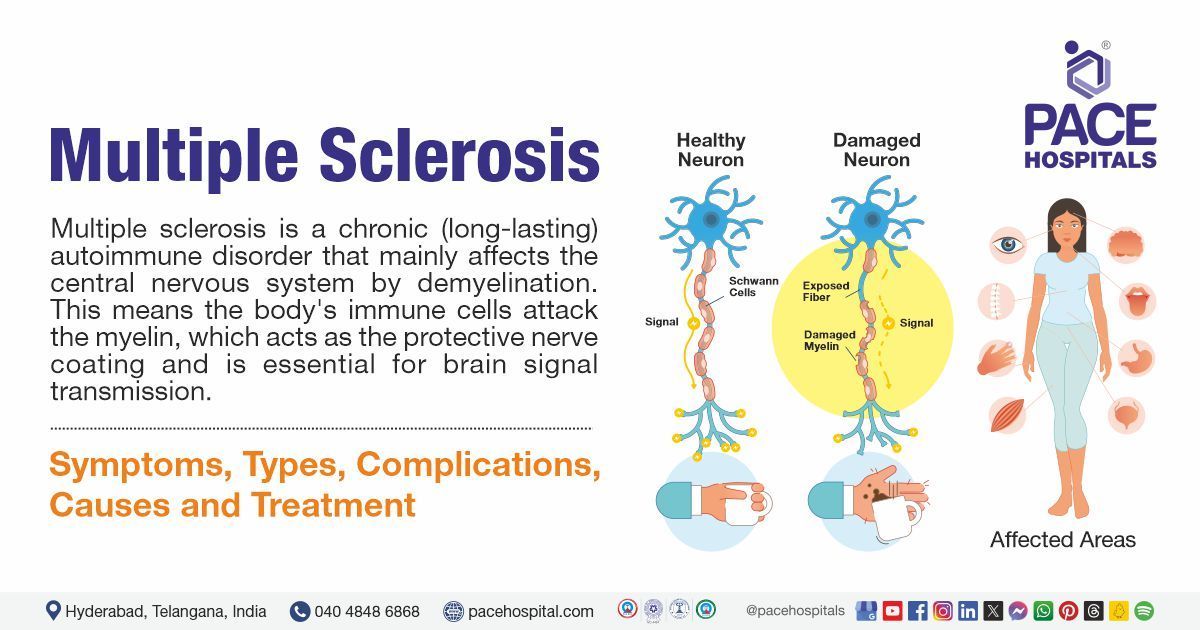 Multiple Sclerosis Symptoms Causes Diagnosis Treatment Multiple Sclerosis Symptoms Causes Diagnosis Treatment