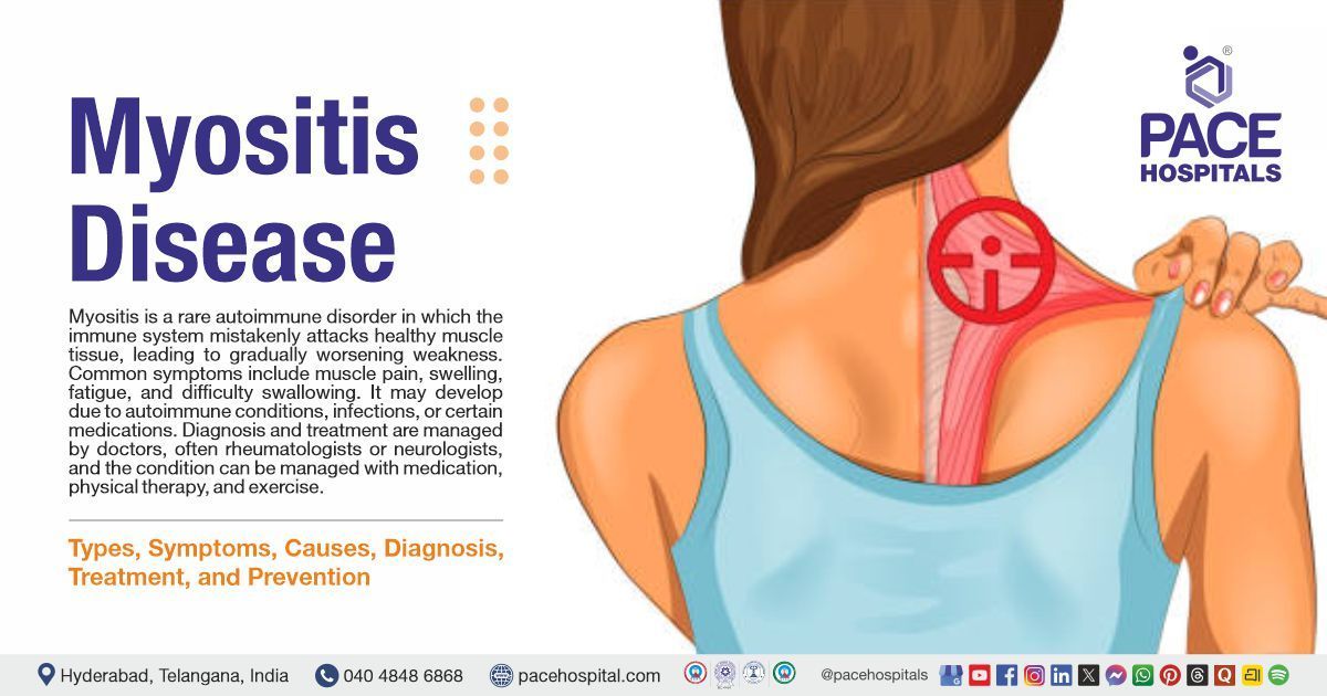 Myositis Disease Types Symptoms Causes Diagnosis Treatment