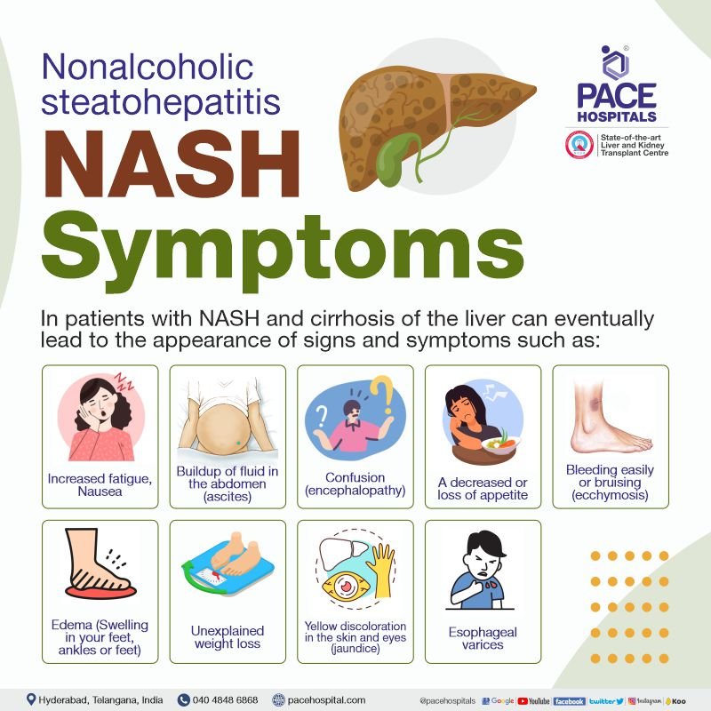 NAFLD & NASH Symptoms, Causes, Differences & Treatment Options