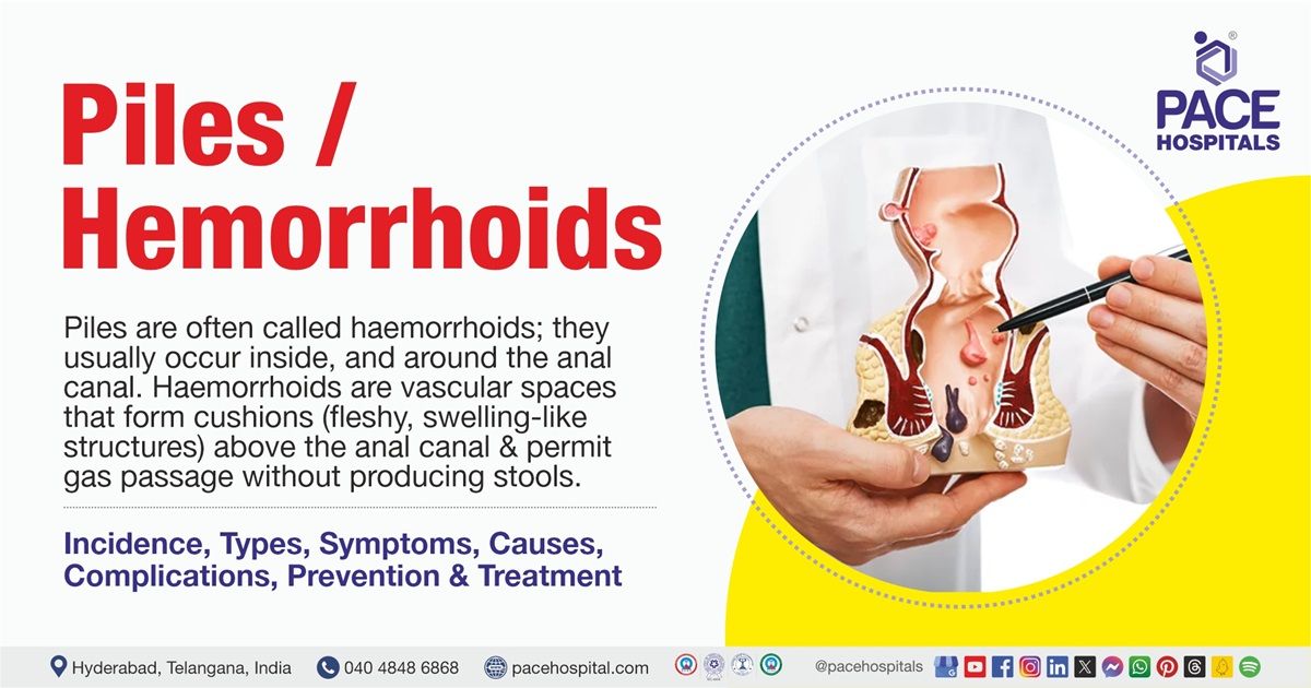 Pileshemorrhoids Causes Symptoms Treatment Youtube