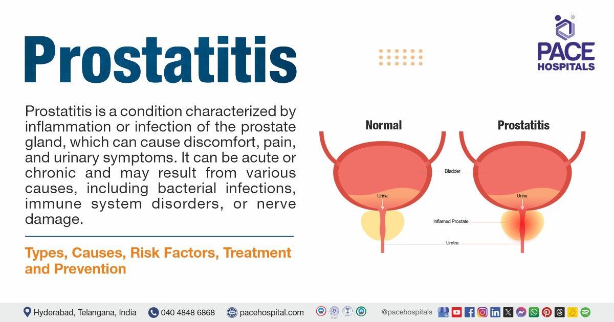 Common Causes Of Prostate Infection
