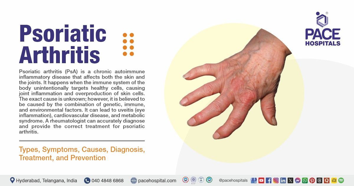 glutathione psoriatic arthritis Psoriatic Arthritis: Symptoms, Causes, Treatment & Prevention