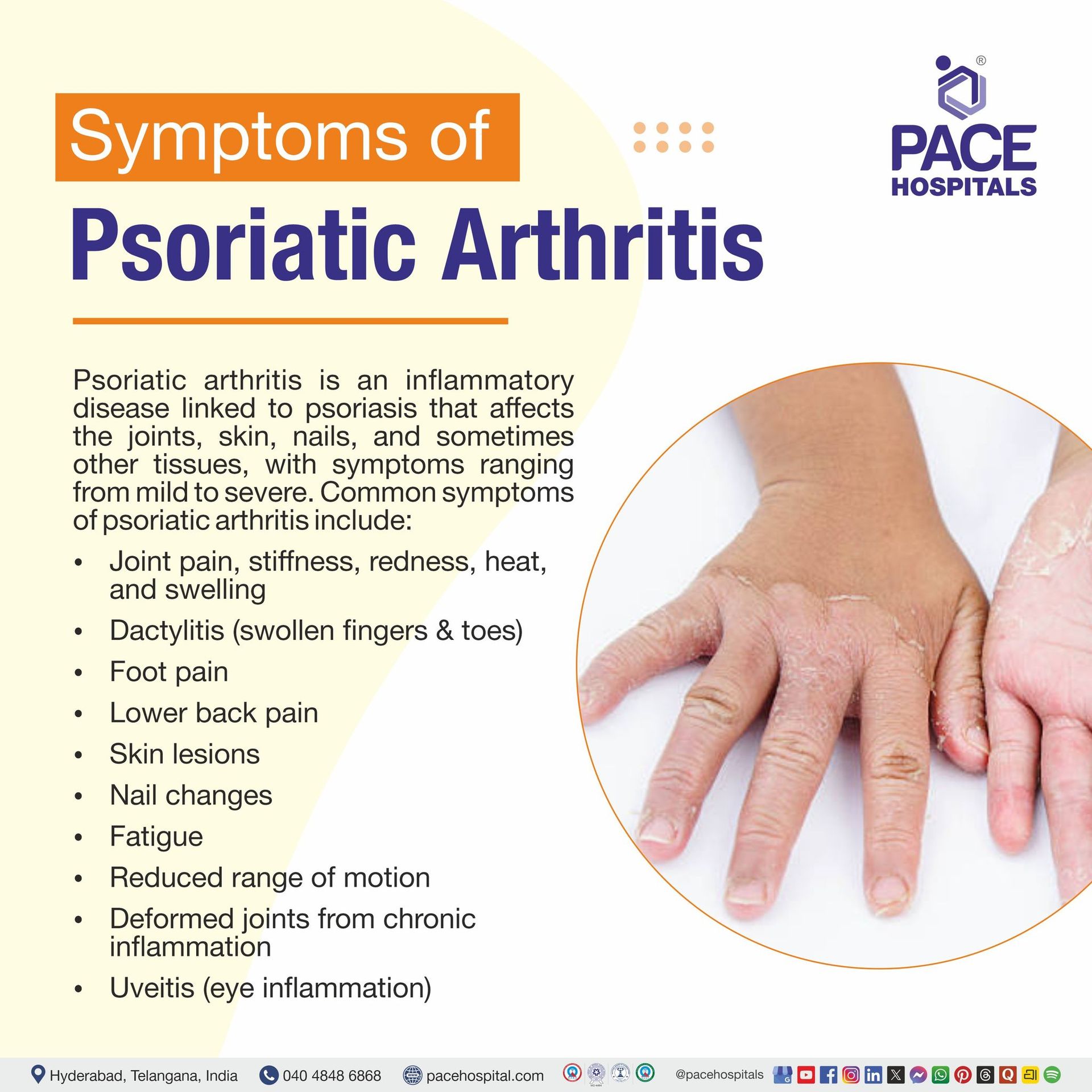 Posiatic Rash Psoriatic Arthritis: Symptoms, Causes, Treatment & Prevention