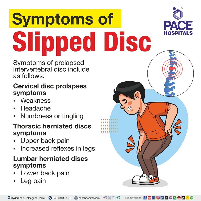 Slipped disc (Herniated disc) Causes, Symptoms and Treatment