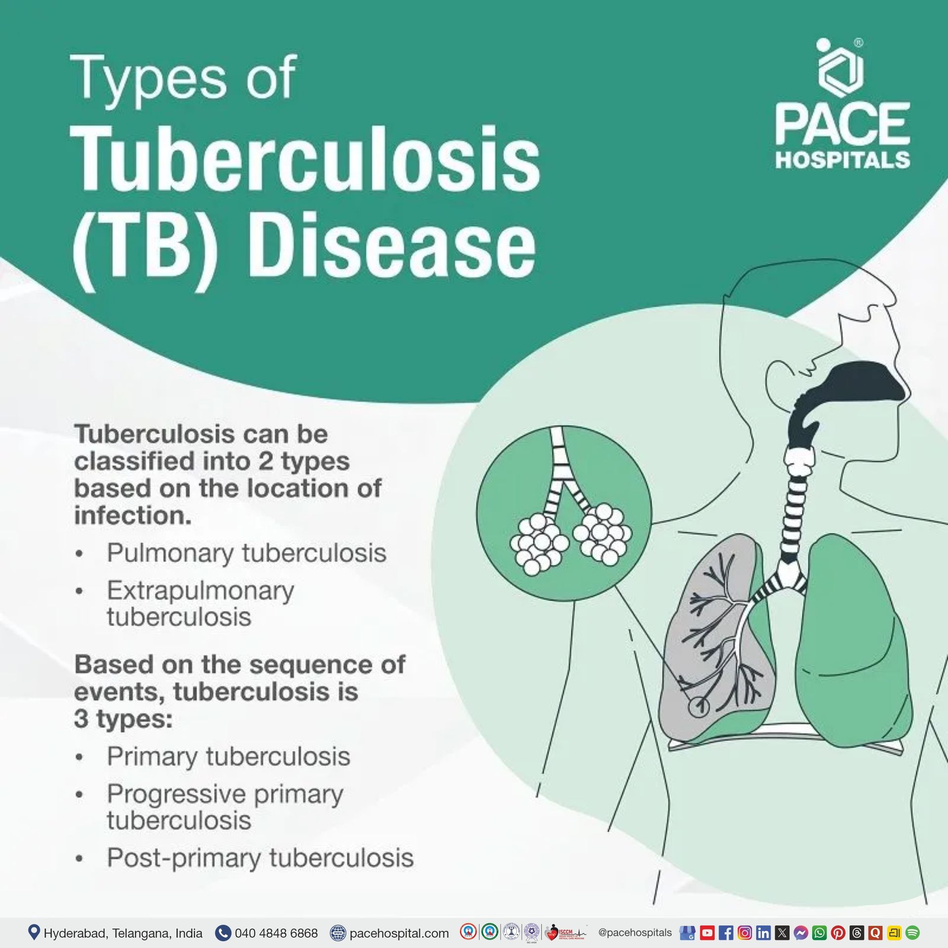 Tuberculosis - Symptoms, Types, Causes, Risk factors & Prevention