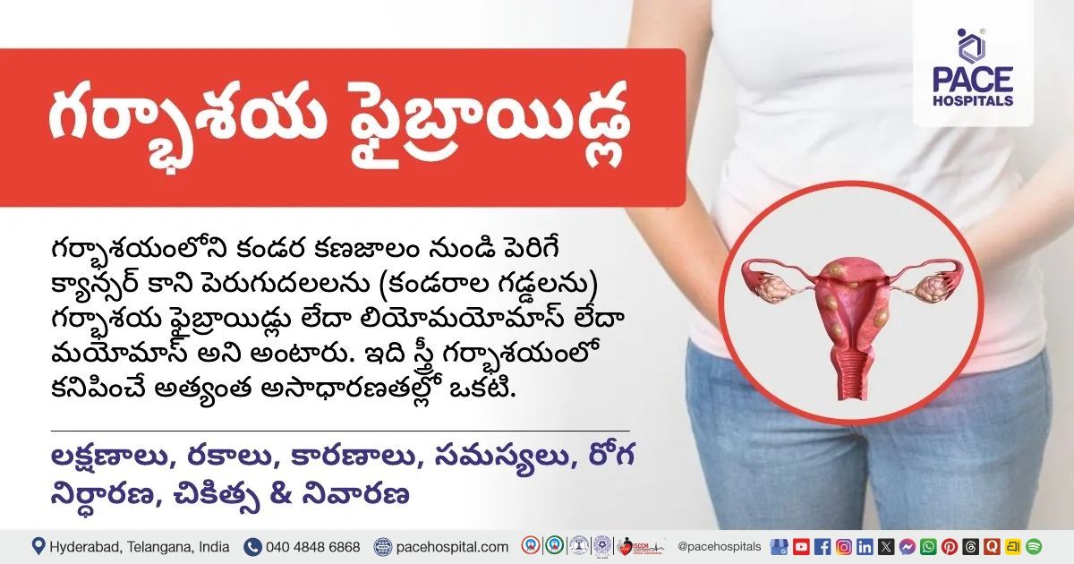 గర్భాశయ ఫైబ్రాయిడ్ల: లక్షణాలు, రకాలు, కారణాలు, సమస్యలు, రోగ నిర్ధారణ, చికిత్స & నివారణ