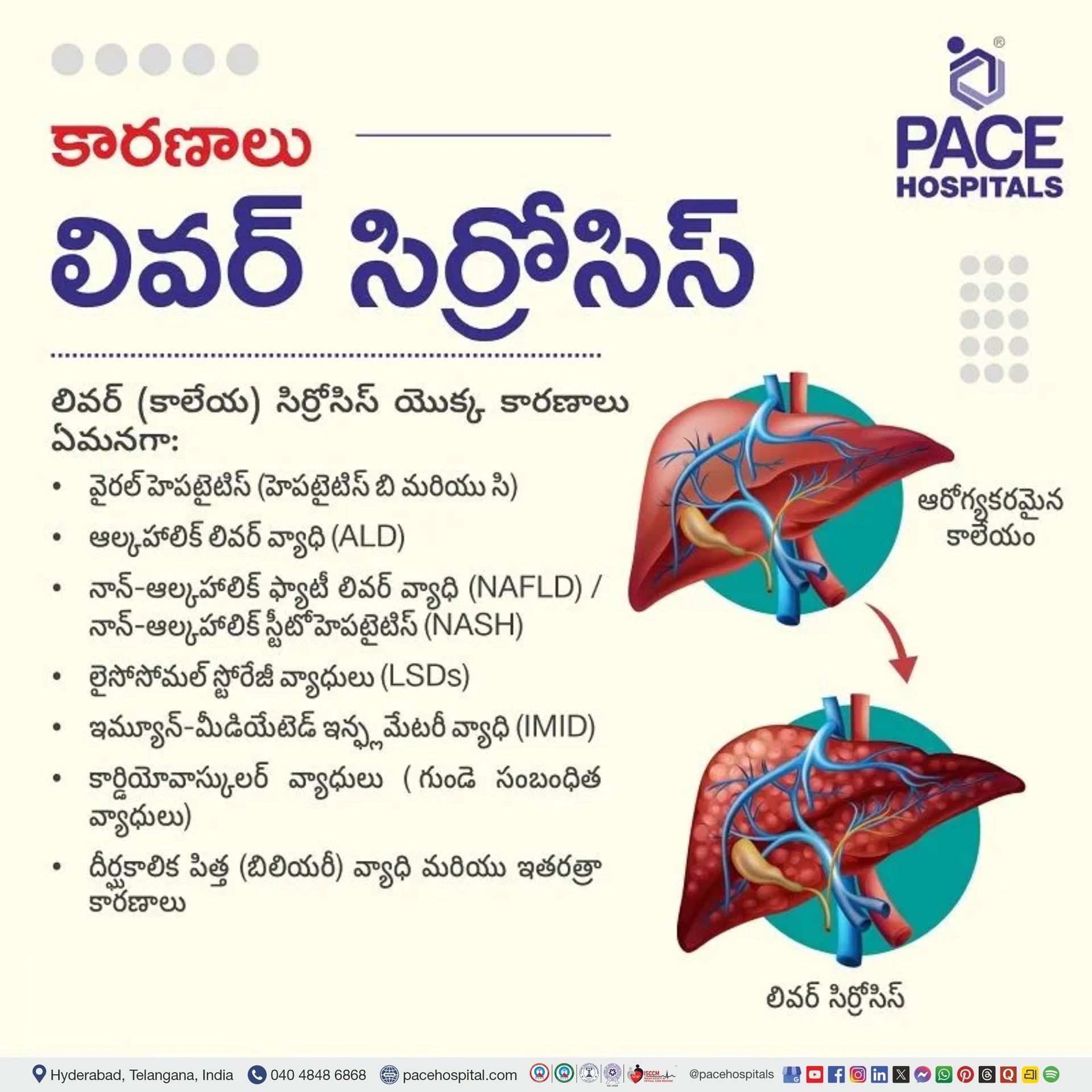 liver cirrhosis causes in telugu liver cirrhosis causes telugu | etiology of liver cirrhosis in telugu | liver cirrhosis reason in telugu