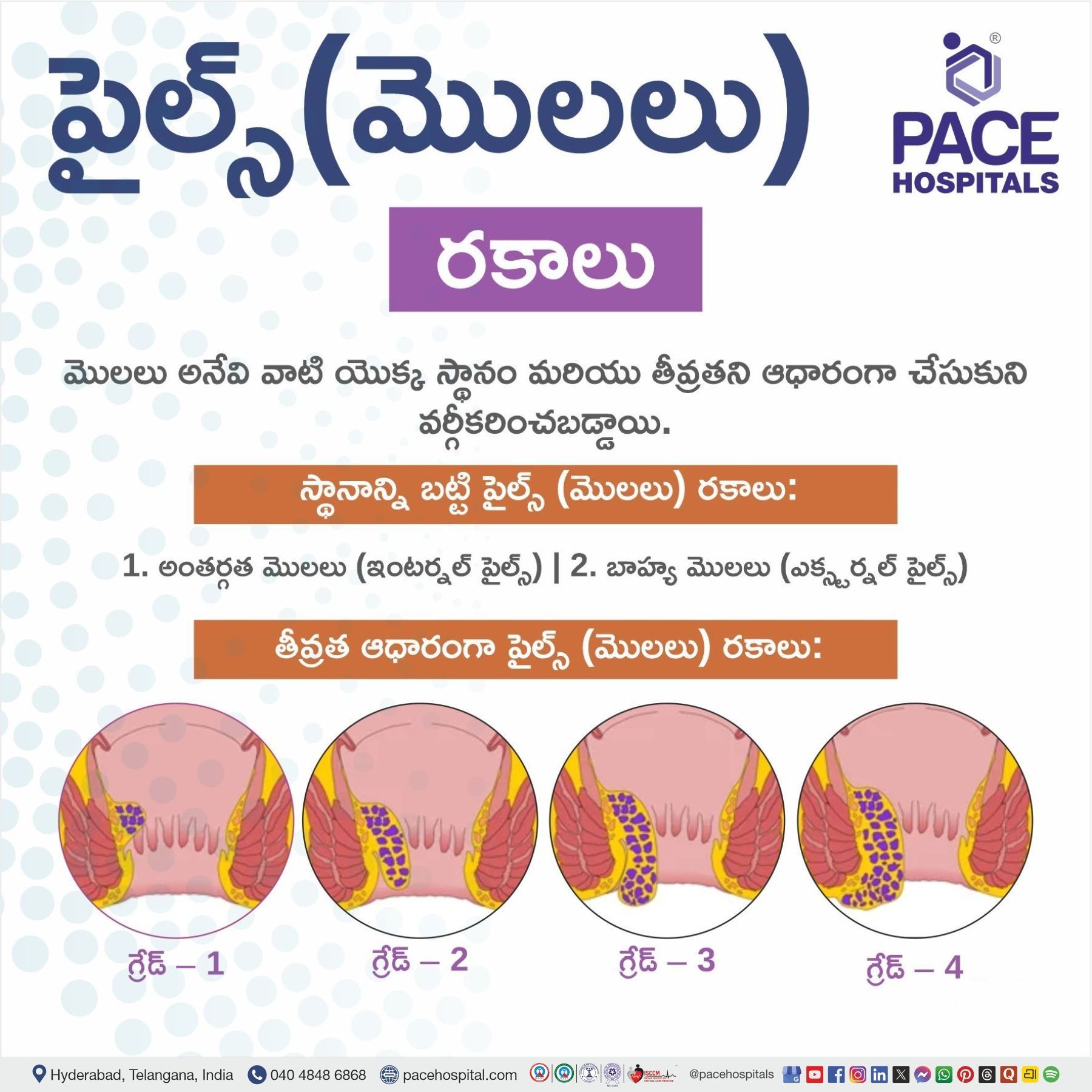 piles types in telugu | how many types of piles disease in telugu | types of hemorrhoids in telugu meaning