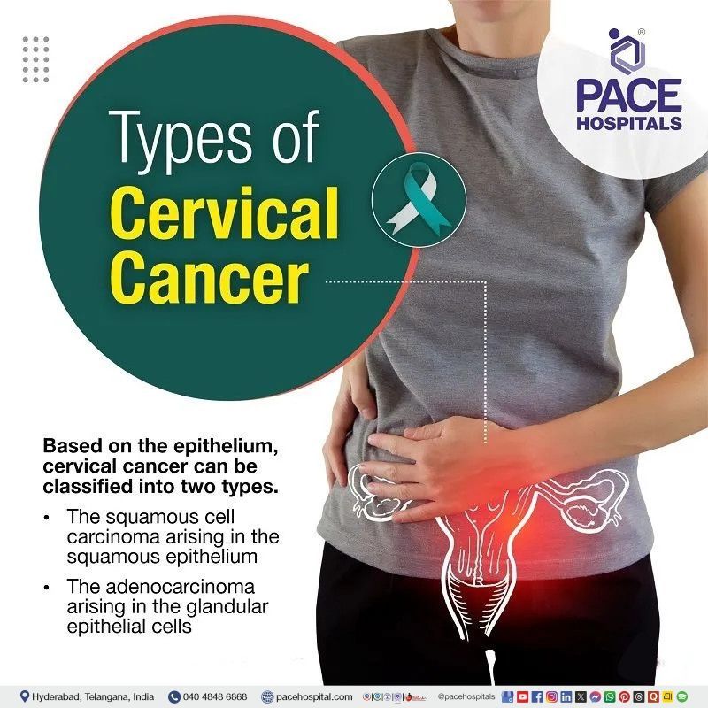 types of cervical cancer