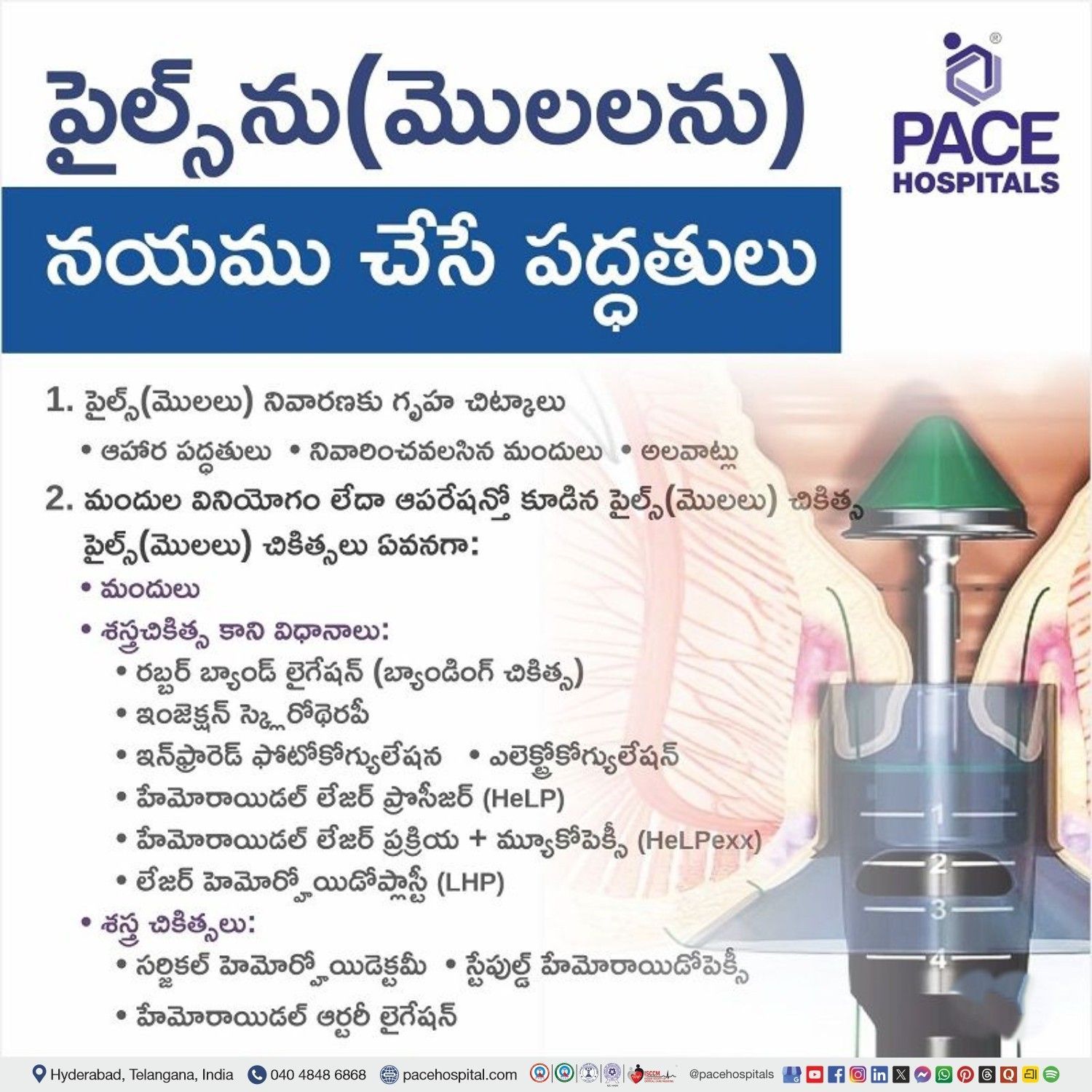 piles treatment in telugu | how to reduce piles in telugu | hemorrhoids piles operation telugu | how to reduce piles pain in telugu