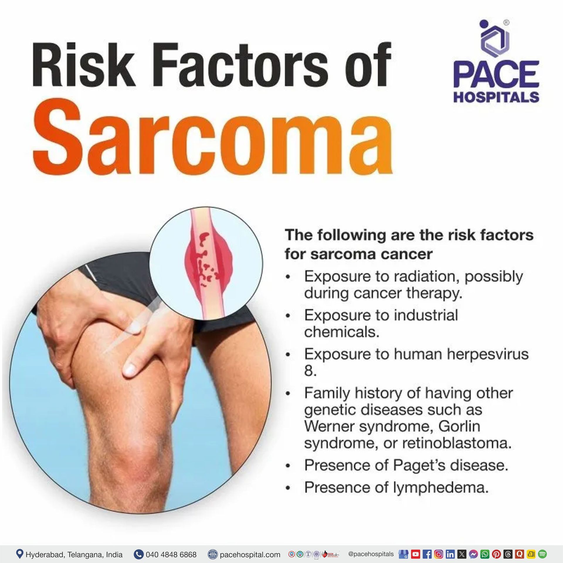 Risk factors of Sarcoma and Bone Cancer Sarcoma and Bone Cancer Awareness Month | Risk factors of Sarcoma | Sarcoma risk factors | Visual narrating the risk factors of sarcoma cancer