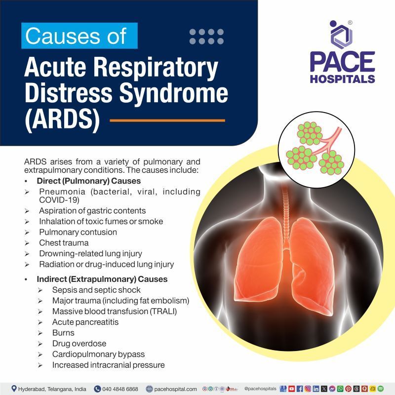 ARDS Causes ARDS Causes | What causes ards | Acute respiratory distress syndrome causes