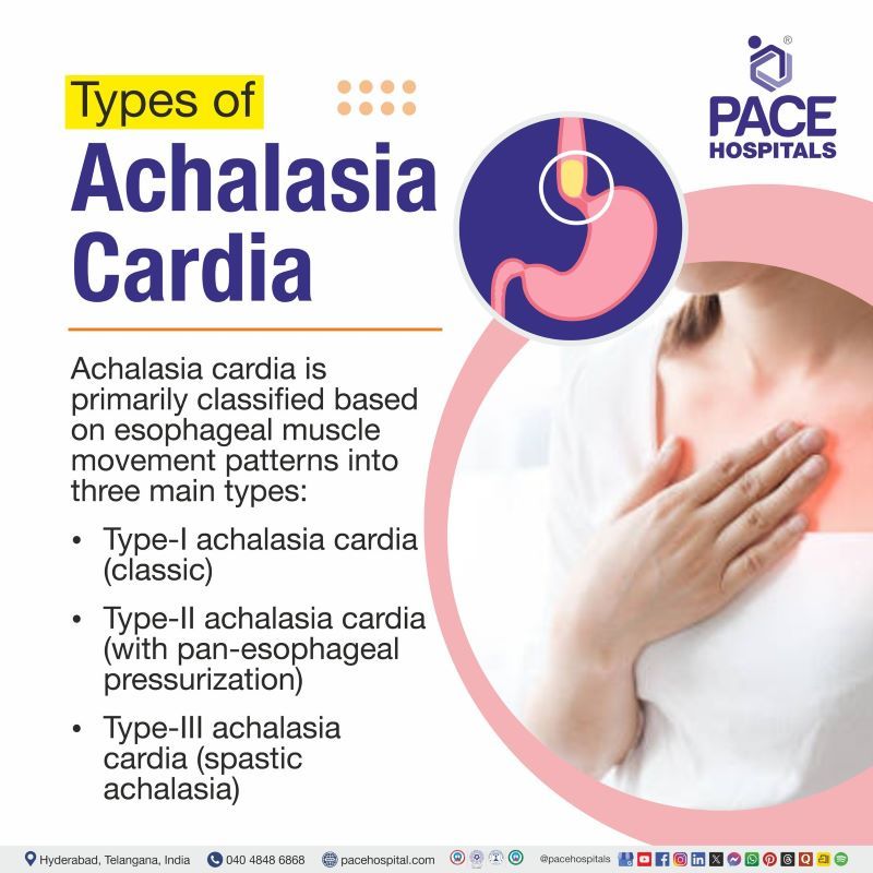 Achalasia Cardia Types | Types of Achalasia Cardia