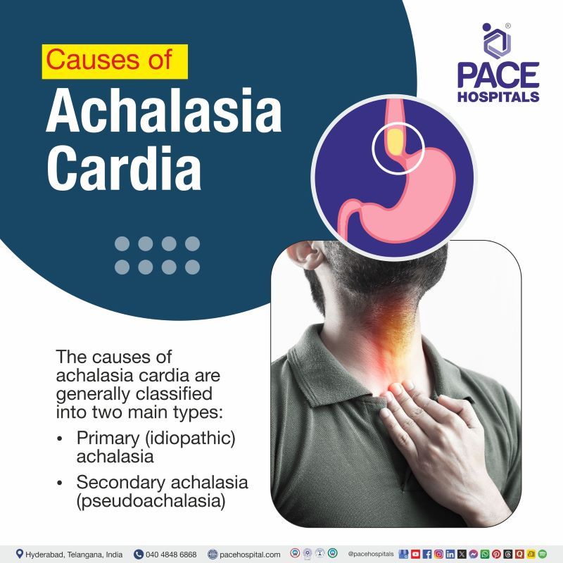 Achalasia Cardia Causes | Causes of Achalasia Cardia