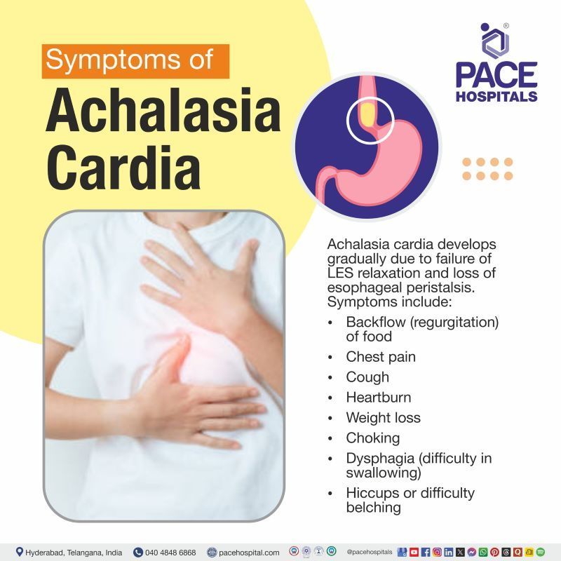 Achalasia Cardia Symptoms | Symptoms of Achalasia Cardia