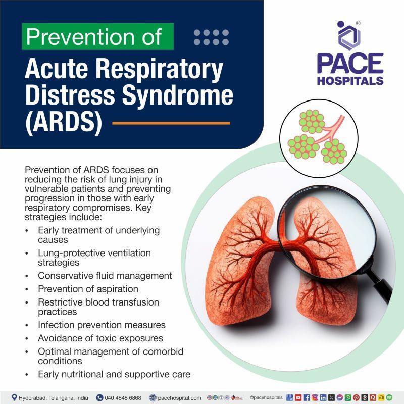 ARDS Prevention ARDS Prevention | Acute respiratory distress syndrome Prevention