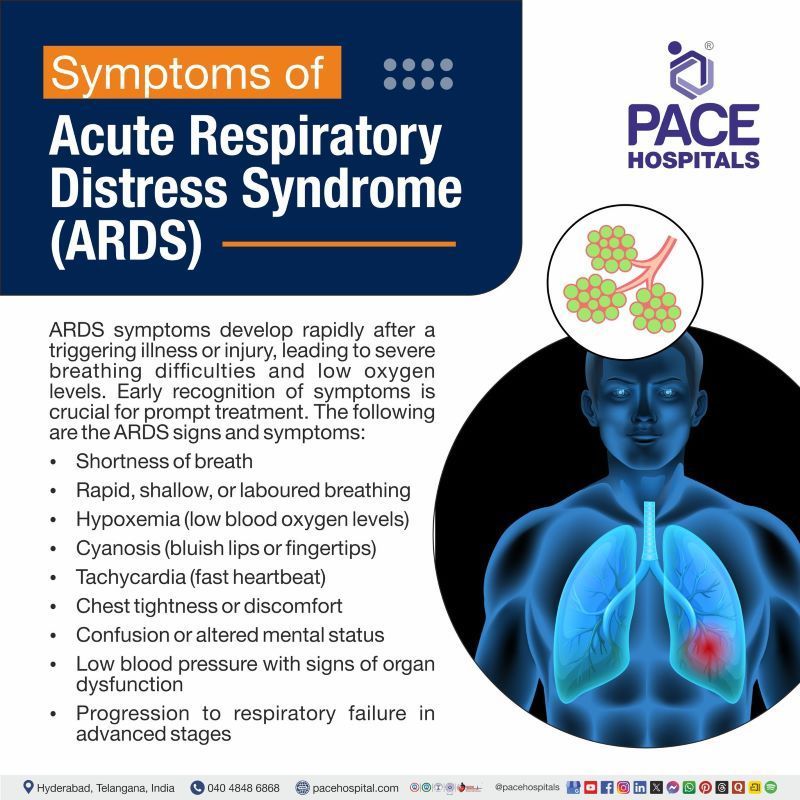 ARDS Symptoms Acute respiratory distress syndrome symptoms | ARDS symptoms | ARDS signs and symptoms