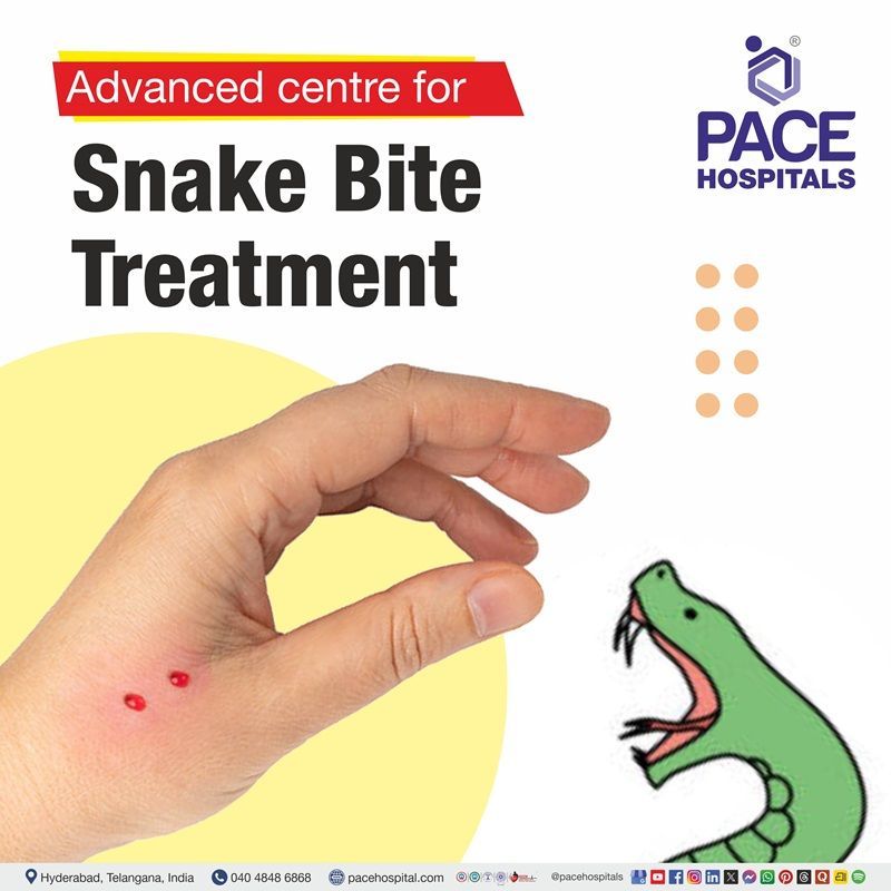 Advanced Centre for Snake Bite Treatment in Hyderabad, India snake bite hospital near me | snake bite treatment hospital in Hyderabad | best hospital for snake bite treatment in Hyderabad, India