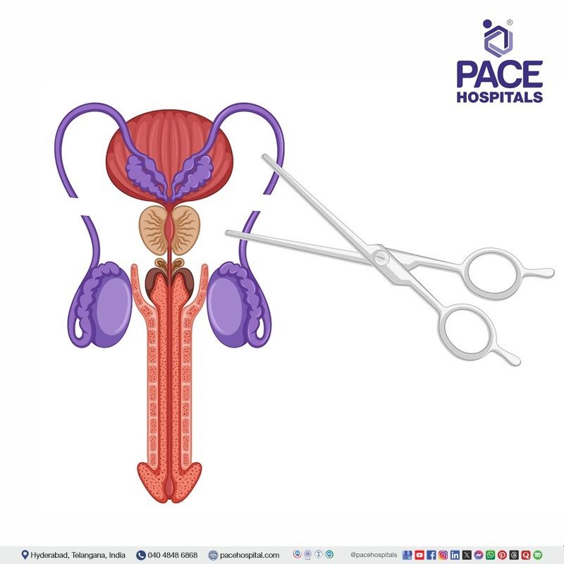 Male infertility treatment at PACE Hospitals, Hyderabad, India | Best hospital for male fertility test and treatment in Hyderabad, India