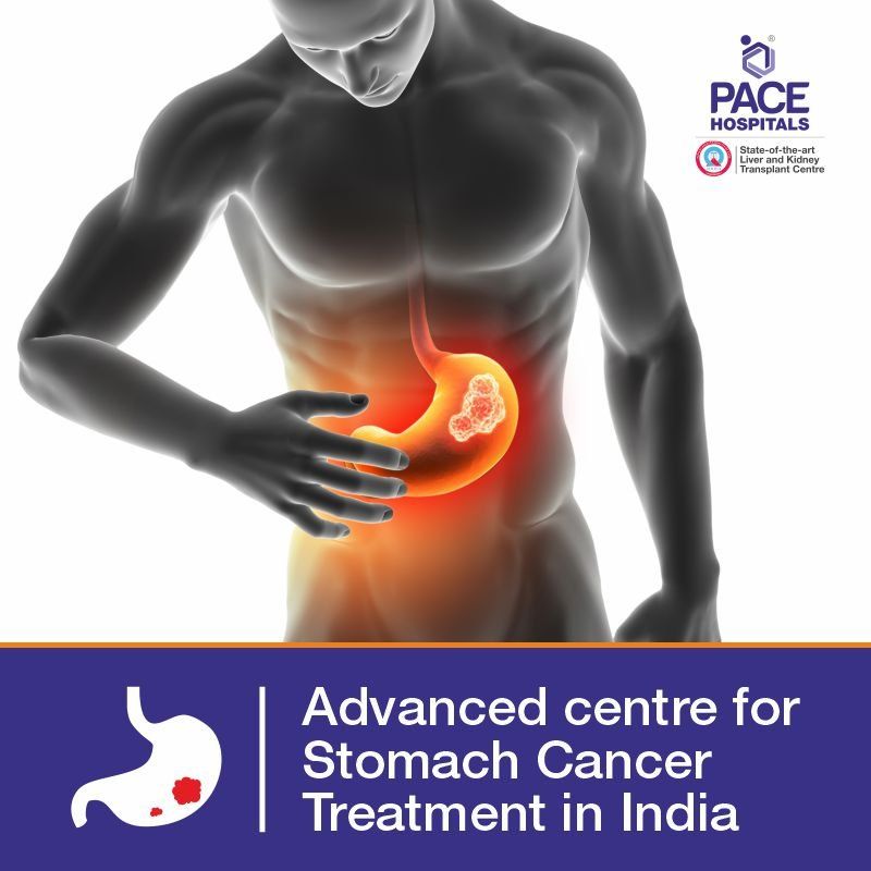 Advanced Centre for Stomach Cancer Treatment Best Hospital for stomach cancer treatment in Hyderabad