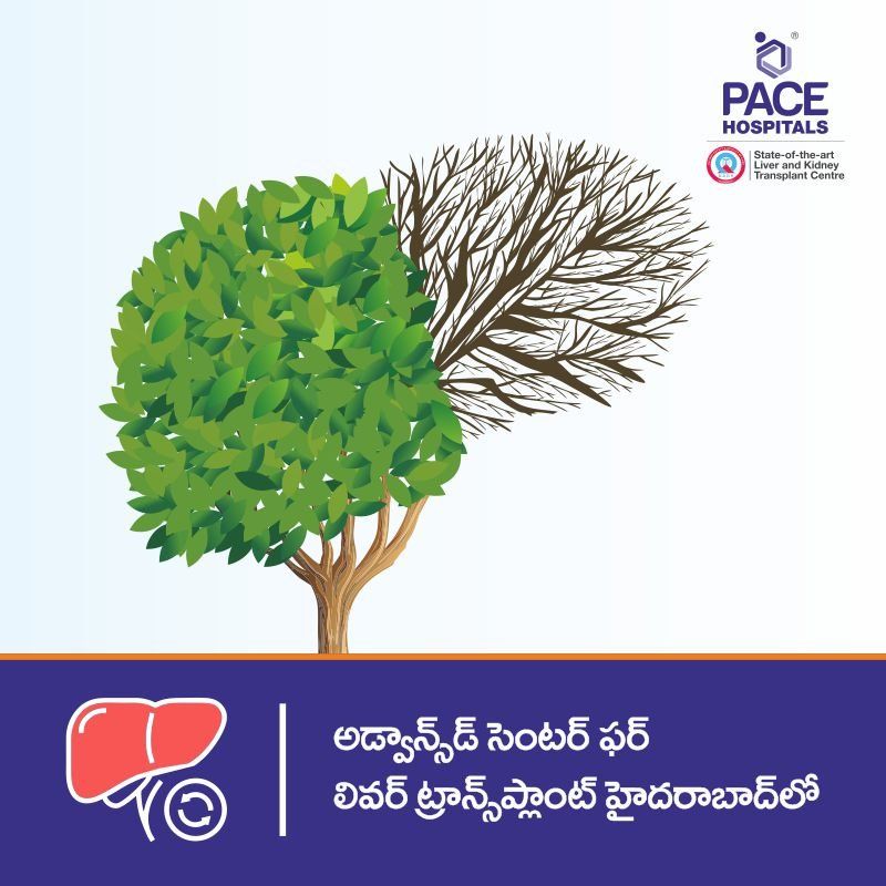 తెలంగాణలోని హైదరాబాద్లో కాలేయ మార్పిడి కోసం అధునాతన కేంద్రం తెలంగాణలోని హైదరాబాద్లో కాలేయ మార్పిడి కోసం అధునాతన కేంద్రం