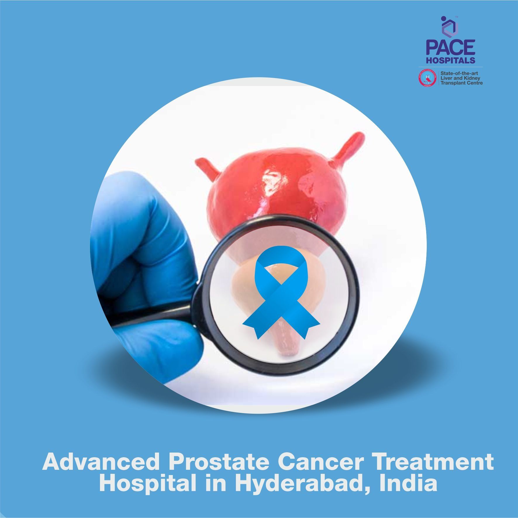Advanced Prostatic Carcinoma Treatment Hospital in Hyderabad, India Advanced Prostate Cancer Treatment Hospital in Hyderabad, India - Prostatic Carcinoma