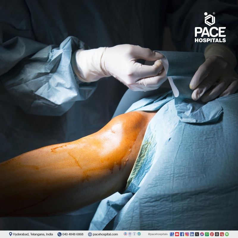 Best Sports Injury Specialist Hospital in Hyderabad, Telangana, India Sports injury treatment at PACE Hospitals, Hyderabad, India | Best hospital for Sports medicine and treatment in Hyderabad, Telangana, India