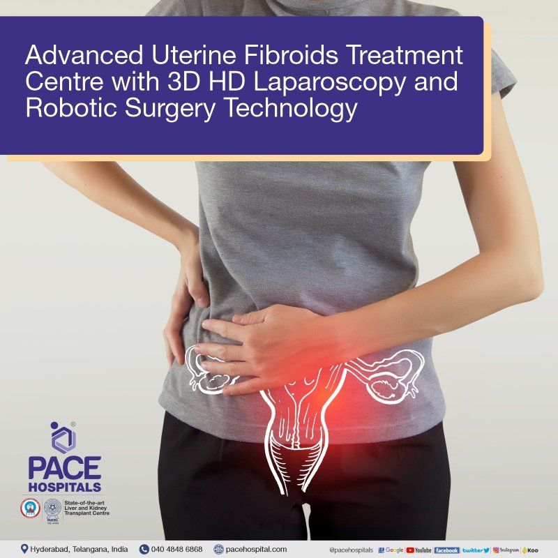 Uterine Fibroid Surgery in Hyderabad Uterine Fibroid Surgery in Hyderabad | Fibroids Laparoscopic surgery | Robotic Surgery For Uterine Fibroids