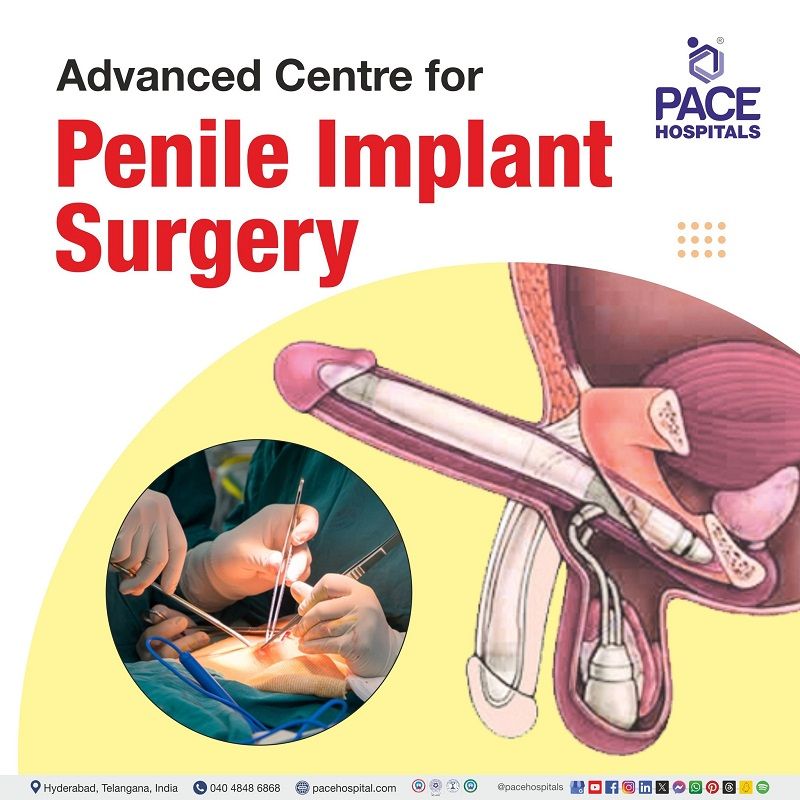 Penile implant surgery in Hyderabad, India | Visual depicting the doctors performing the penile implant surgery