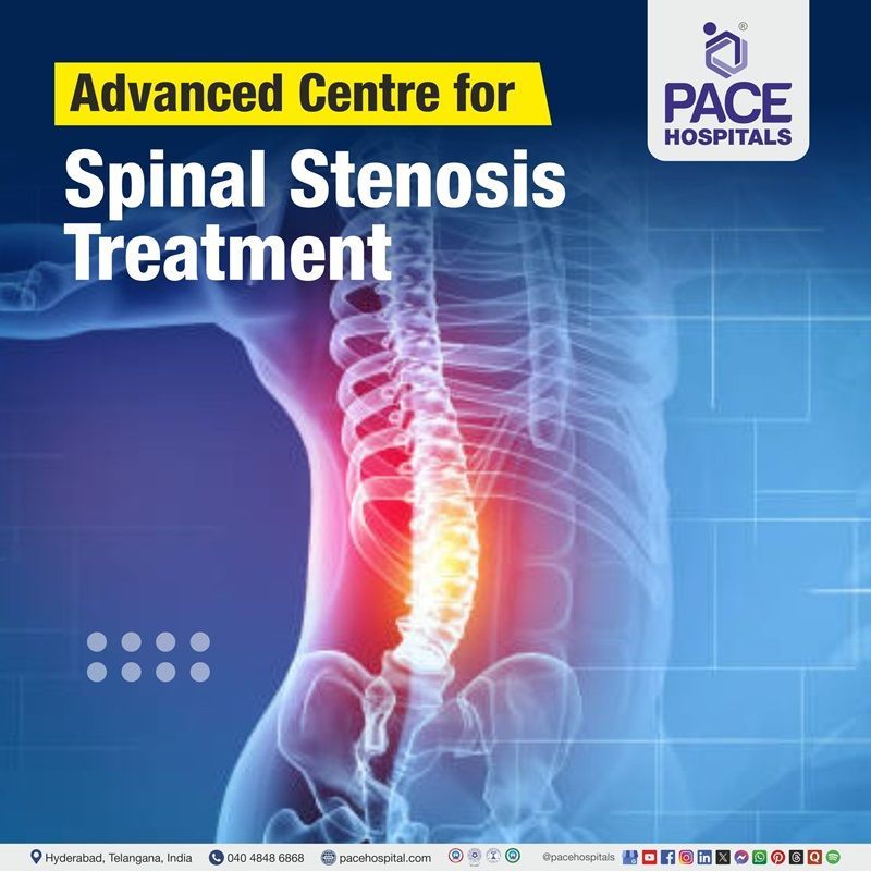 Advanced Centre for Spinal Stenosis Treatment in Hyderabad, Telangana, India Best hospitals for Spinal Stenosis Treatment in Hyderabad, India | Spinal Stenosis Treatment Hospital in Hyderabad, India