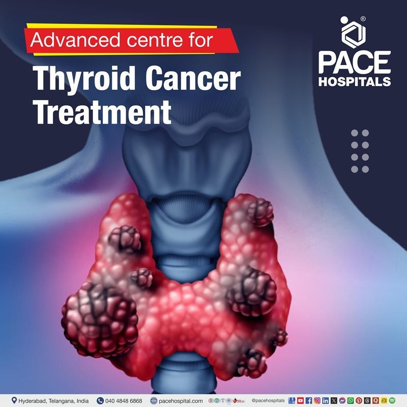 Advanced Centre for Thyroid Cancer Treatment in Hyderabad, India Thyroid cancer treatment hospital in Hyderabad | Best hospital for thyroid cancer treatment in Hyderabad, India