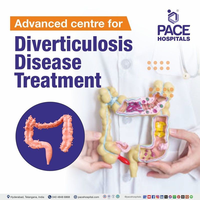 Advanced Centre for Diverticulosis Disease Treatment in Hyderabad, India Best hospitals for diverticulosis disease Treatment in Hyderabad, India | diverticulosis disease Treatment Hospital in Hyderabad, India | Centre for diverticulosis Treatment in Hyderabad, India