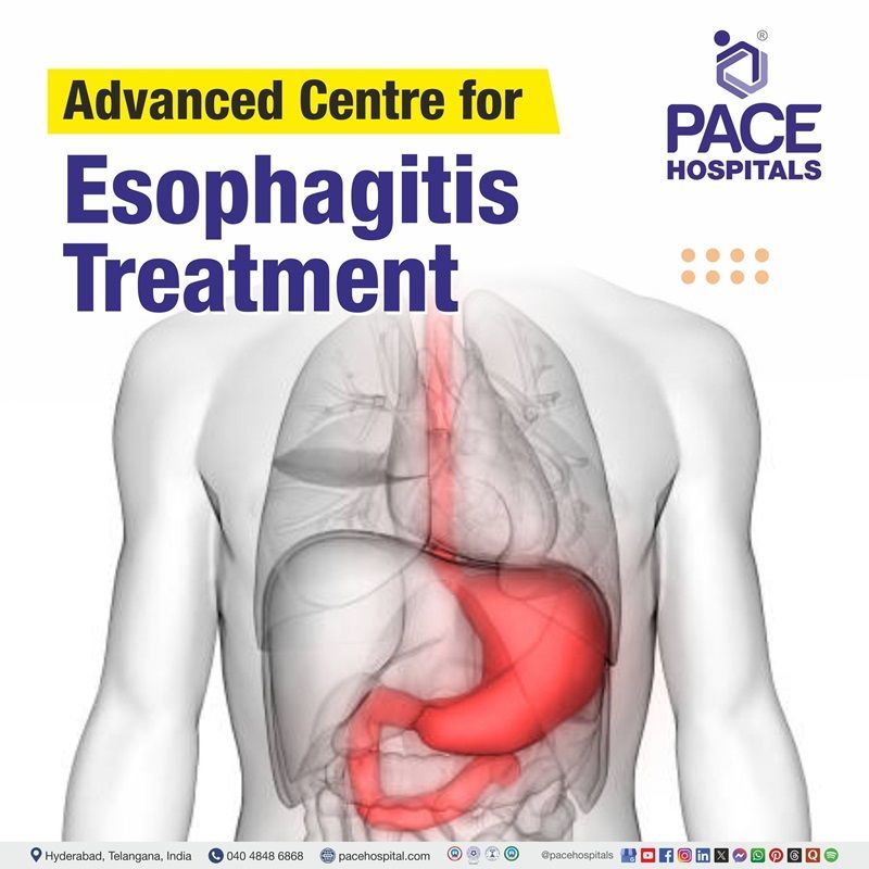Advanced Centre for Esophagitis Treatment in Hyderabad, Telangana, India Best hospitals for Esophagitis Treatment in Hyderabad, India | Esophagitis Treatment Hospital in Hyderabad, India | Centre for Osteoarthritis Treatment in Hyderabad, India