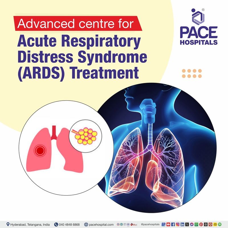 Advanced Centre for Acute Respiratory Distress Syndrome (ARDS) Treatment in Hyderabad, Telangana, India Best Hospital for ARDS Treatment in Hyderabad | Acute Respiratory Distress Syndrome Treatment in Hyderabad, India