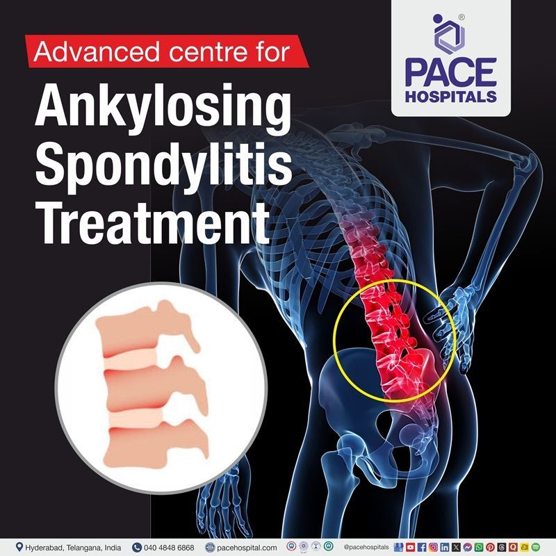 Advanced Centre for Ankylosing Spondylitis Treatment in Hyderabad, Telangana, India best hospital for ankylosing spondylitis in Hyderabad, India | ankylosing spondylitis diagnosis and Treatment in Hyderabad, India