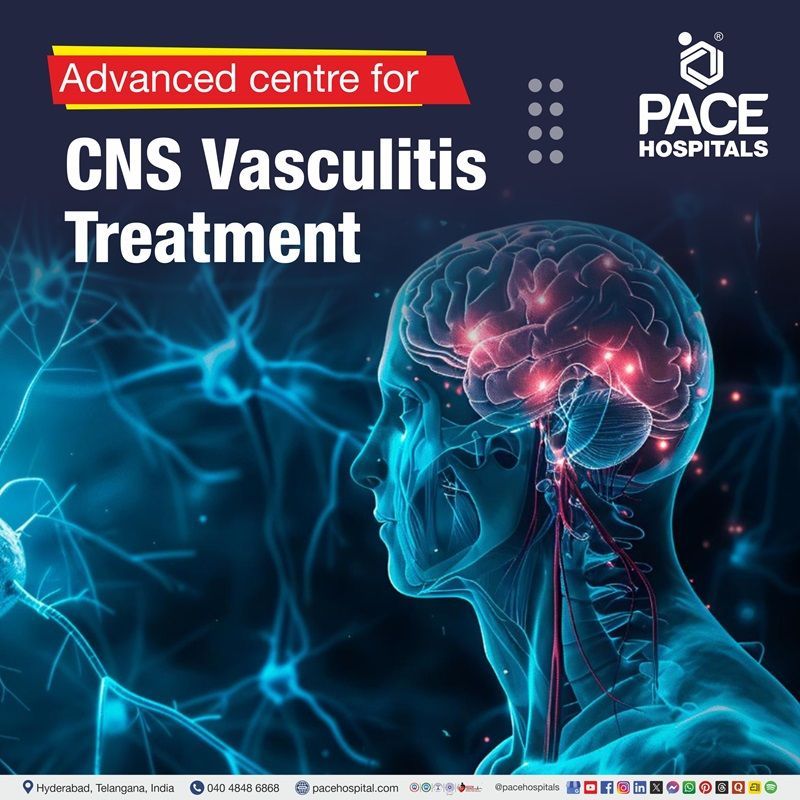 Advanced Centre for CNS Vasculitis Treatment in Hyderabad, India cns vasculitis treatment hospital in Hyderabad | best hospital for central nervous system vasculitis treatment in Hyderabad, India