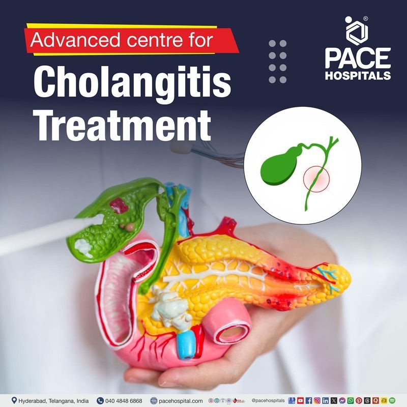 cholangitis treatment hospital in Hyderabad | best hospital for cholangitis treatment in Hyderabad, India