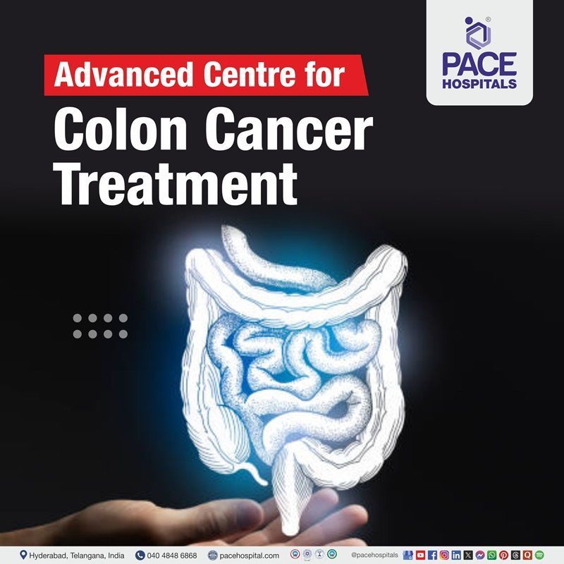 Advanced Colon Cancer Treatment Hospital in Hyderabad, Telangana, India Best Colon Cancer Hospital in Hyderabad, India | Advanced Colon Cancer Treatment