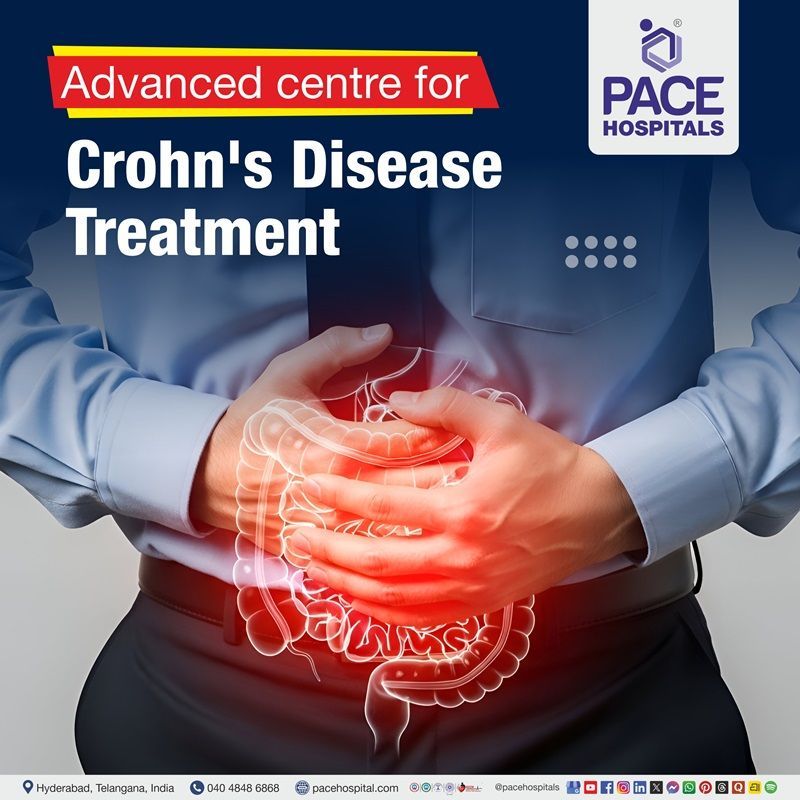 Advanced Centre for Crohn’s Disease Treatment in Hyderabad, India Management of crohn's disease in Hyderabad | Crohn’s Disease diagnosis near me | Crohn’s Disease treatment in Hyderabad