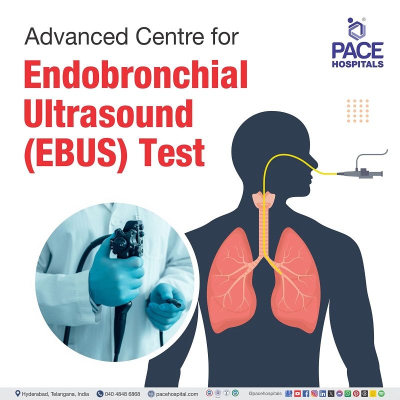 Best Endobronchial ultrasound (EBUS) test centre in Hyderabad Advanced centre for Endobrochial Ultrasound test | EBUS test centre | Endobronchial ultrasound (EBUS) Procedure centre | Best hospital for EBUS test in Hyderabad | EBUS test cost in Hyderabad | EBUS test near me | endobronchial ultrasound bronchoscopy in India