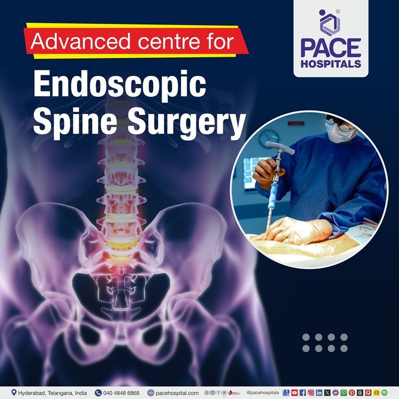 Advanced Centre for Endoscopic Spine Surgery in Hyderabad, India Best Hospital for endoscopic spine surgery in Hyderabad | endoscopic spine surgery in Hyderabad, India