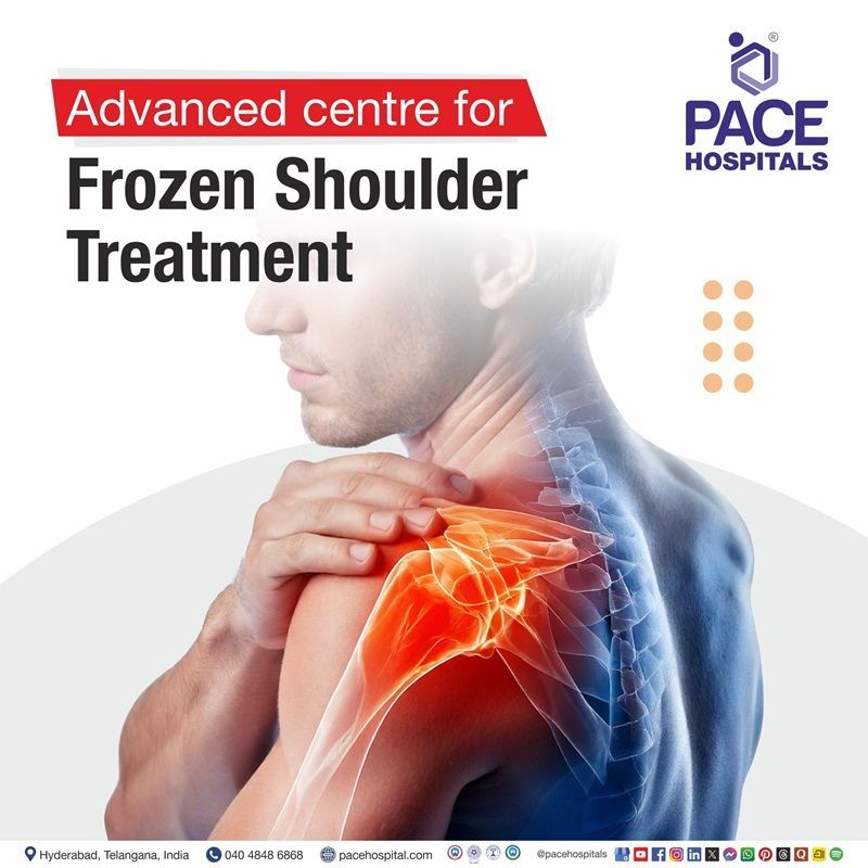 Advanced Centre for Frozen Shoulder Treatment in Hyderabad, Telangana, India Best Hospital for Frozen Shoulder Surgery in Hyderabad, India | Frozen Shoulder diagnosis and Treatment in Hyderabad, India