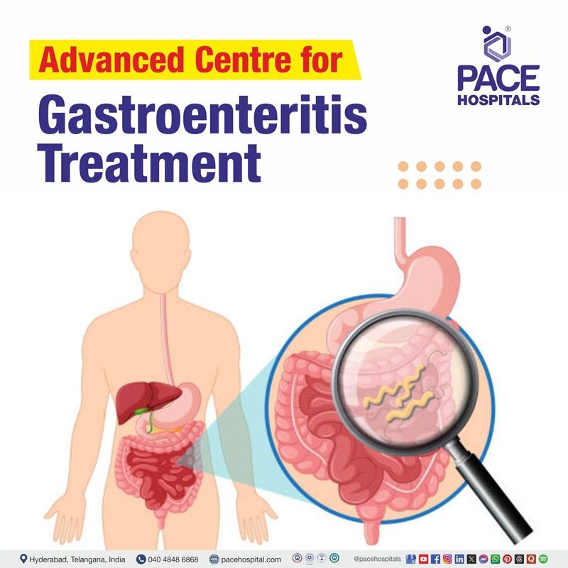 Advanced Centre for Gastroenteritis Treatment in Hyderabad, Telangana, India Best gastroenteritis hospital in Hyderabad, India | Best Hospital for Gastroenteritis Treatment in Hyderabad, India