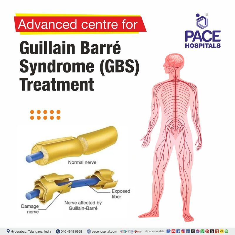 Advanced Centre for Guillain-Barre Syndrome (GBD) Treatment in Hyderabad, India Best Hospital for Guillain barre syndrome management in Hyderabad | Guillain barre syndrome (GBS) treatment Hospital in Hyderabad, India