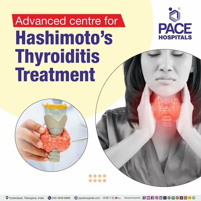 Advanced Centre for Hashimoto's Thyroiditis Treatment in Hyderabad, Telangana, India Best Hospital for hashimoto's thyroiditis Disease Treatment in Hyderabad | Hashimot treatment Hospital in Hyderabad, India