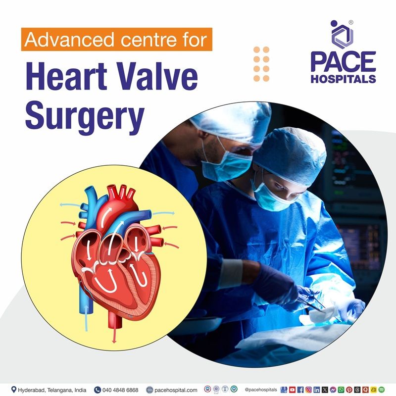 Best Hospital for Heart Valve Replacement & Repair Surgery in Hyderabad, India Best Hospital for Heart Valve Operation in Hyderabad, India | Heart Valve Surgery Hospital in Hyderabad, India