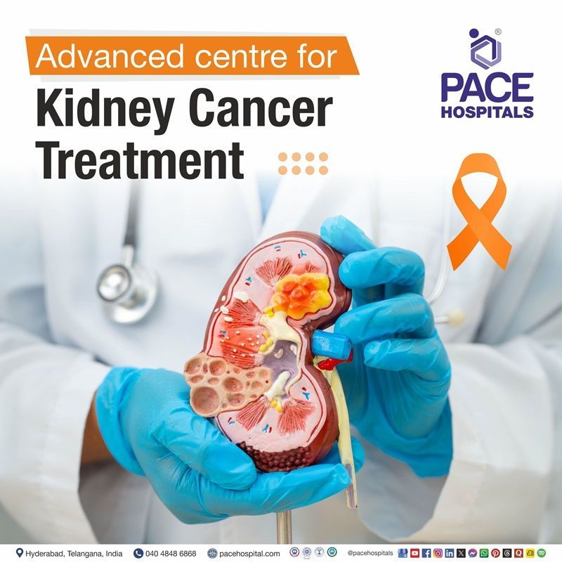 Advanced Centre for Kidney Cancer Treatment in Hyderabad, Telangana, India Best Hospital for Renal Cancer Treatment in Hyderabad | Renal Cell Carcinoma Treatment in Hyderabad | Top Hospital for Kidney Cancer Treatment in Hyderabad, India