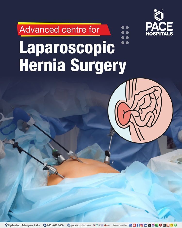 Top Hospital for Laparoscopic Hernia Surgery in Hyderabad, India Best Hospital near me for Laparoscopic Hernia Surgery in Hyderabad, India | Advanced Center for Laparoscopic hernia repair in Hyderabad in Hyderabad, India | Top Hospital for Laparoscopic hernia operation